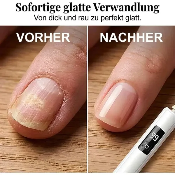 NAILJET-3831127663803-DE-7__060826.webp