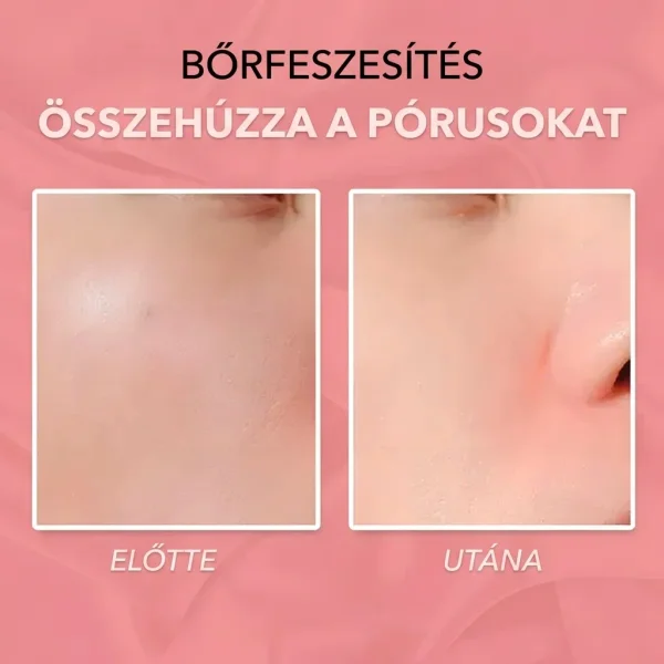 b1ccaa183593f8_BLOOMSTICK-3831127521140-HU-7__211026.webp
